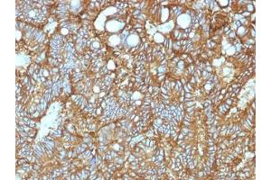 SDS-PAGE (SDS) image for anti-Epithelial Cell Adhesion Molecule (EPCAM) (AA 202-209), (Extracellular Domain) antibody (ABIN5646870)