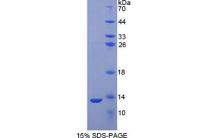 SDS-PAGE analysis of Human S100A2 Protein. (S100A2 蛋白)