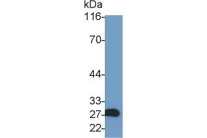Detection of GZMA in Rat Kidney lysate using Polyclonal Antibody to Granzyme A (GZMA) (GZMA 抗体  (AA 29-260))