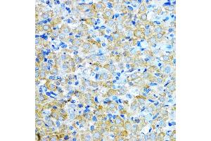 Immunohistochemistry of paraffin-embedded rat ovary using Aromatase (CYP19) antibody  at dilution of 1:100 (40x lens).