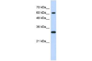 WB Suggested Anti-ERF Antibody Titration:  0. (ERF 抗体  (Middle Region))