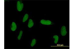 Immunofluorescence of purified MaxPab antibody to ZNF193 on HepG2 cell. (Zinc Finger and SCAN Domain Containing 9 (ZSCAN9) (AA 1-394) 抗体)