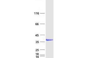 Validation with Western Blot