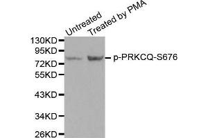 Western blot analysis of extracts from PC12 cells using Phospho-PRKCQ-S676 antibody. (PKC theta 抗体  (pSer676))