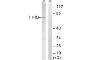 Western blot analysis of extracts from Jurkat cells, treated with etoposide 25uM 24H, using THRB (AP2,Cleaved-Arg327) Antibody. (THRB 抗体  (Cleaved-Arg327))