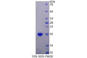 SDS-PAGE analysis of Human TRAPPC2 Protein. (TRAPPC2 蛋白)