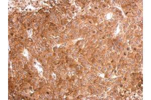 IHC-P Image Tau antibody detects MAPT protein at cytosol on D54MG xenograft by immunohistochemical analysis. (MAPT 抗体)