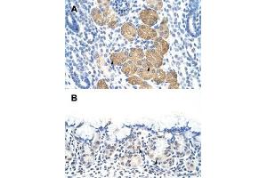 Immunohistochemical staining (Formalin-fixed paraffin-embedded sections) of human kidney (A) and human stomach (B) with DAZ4 polyclonal antibody  at 4-8 ug/mL working concentration. (DAZ4 抗体  (N-Term))