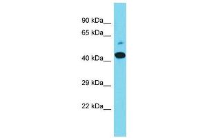 Host:  Rabbit  Target Name:  Maml2  Sample Type:  Mouse Stomach lysates  Antibody Dilution:  1. (MAML2 抗体  (C-Term))