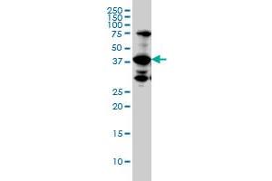 UROD monoclonal antibody (M01A), clone 1G4. (UROD 抗体  (AA 268-367))