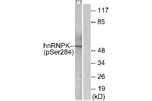 Western blot analysis of extracts from 3T3 cells, treated with EGF (200ng/ml, 30mins), using hnRNP K (Phospho-Ser284) antibody. (HNRNPK 抗体  (pSer284))