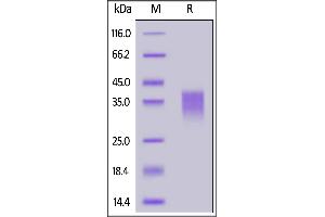 SDS-PAGE (SDS) image for Killer Cell Lectin-Like Receptor Subfamily C, Member 2 (KLRC2) (AA 94-231) protein (His tag) (ABIN7013538)