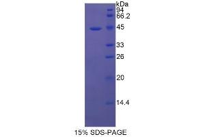 SDS-PAGE analysis of Human Tryptase Protein. (TPSAB1 蛋白)