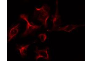 ABIN6274229 staining COLO205 cells by IF/ICC.