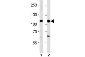 SALL4 antibody western blot analysis in 293,HeLa lysate. (SALL4 抗体  (AA 1009-1039))