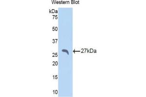 Western blot analysis of the recombinant protein. (APCS 抗体  (AA 22-222))