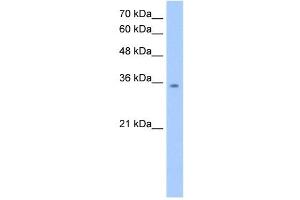 MDH2 antibody used at 2. (MDH2 抗体)
