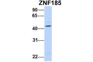 Host:  Rabbit  Target Name:  ZNF185  Sample Type:  Human Fetal Brain  Antibody Dilution:  1. (Zinc Finger Protein 185 抗体  (N-Term))