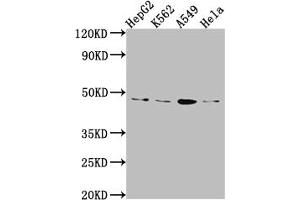 Western Blot Positive WB detected in: HepG2 whole cell lysate, K562 whole cell lysate, A549 whole cell lysate, Hela whole cell lysate All lanes: CD274 Antibody at 1:1000 Secondary Goat polyclonal to rabbit IgG at 1/50000 dilution Predicted band size: 34, 21, 21 kDa Observed band size: 45 kDa (Recombinant PD-L1 抗体)