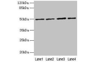 Western blot All lanes: EVA1C antibody at 5 μg/mL Lane 1: Hela whole cell lysate Lane 2: Jurkat whole cell lysate Lane 3: 293T whole cell lysate Lane 4: HL60 whole cell lysate Secondary Goat polyclonal to rabbit IgG at 1/10000 dilution Predicted band size: 50, 8 kDa Observed band size: 50 kDa (EVA1C 抗体  (AA 49-322))