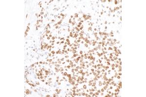 Immunohistochemistry (IHC) image for anti-H2A Histone Family, Member X (H2AFX) (AA 93-143) antibody (ABIN7449530)