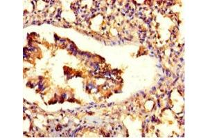 Immunohistochemistry of paraffin-embedded human lung tissue using ABIN7176521 at dilution of 1:100 (ZNF77 抗体  (AA 1-300))