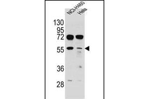 TSPYL6 Antibody (Center) (ABIN655239 and ABIN2844842) western blot analysis in NCI-,Hela cell line lysates (35 μg/lane). (TSPY-Like 6 抗体  (AA 206-235))