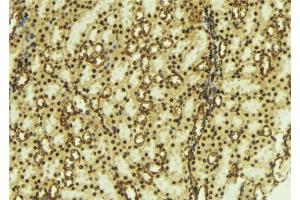 ABIN6277795 at 1/100 staining Mouse kidney tissue by IHC-P.