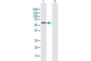 Western Blot analysis of KRT74 expression in transfected 293T cell line by KRT74 MaxPab polyclonal antibody. (KRT74 抗体  (AA 1-529))