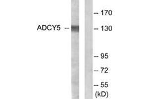 Western blot analysis of extracts from COLO205 cells, using ADCY5/6 Antibody. (ADCY5/6 抗体  (AA 931-980))