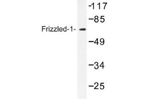 Image no. 1 for anti-Frizzled Family Receptor 1 (Fzd1) antibody (ABIN317638) (FZD1 抗体)