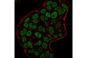 Immunofluorescence (IF) image for anti-MutS Homolog 6 (E. Coli) (MSH6) (AA 374-540) antibody (ABIN6939576)