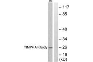 Western blot analysis of extracts from NIH-3T3 cells, using TIMP4 Antibody. (TIMP4 抗体  (AA 175-224))