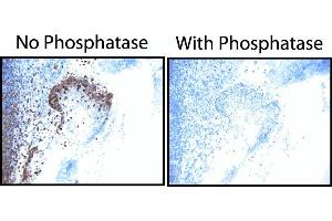EGF Receptor (pY845) staining on tonsil. (EGFR 抗体  (pTyr845))