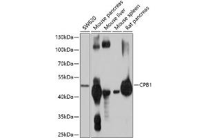 Western blot analysis of extracts of various cell lines, using CPB1 antibody (ABIN6131301, ABIN6138934, ABIN6138935 and ABIN6214759) at 1:1000 dilution. (CPB1 抗体  (AA 111-417))