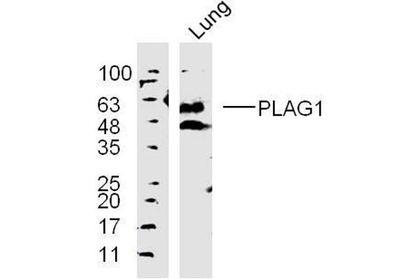 PLAG1 抗体  (AA 51-150)