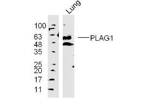 Lane 1: mouse lung lysates probed with 	PLAG1 Polyclonal Antibody, Unconjugated  at 1:300 overnight at 4˚C. (PLAG1 抗体  (AA 51-150))