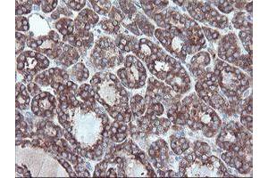 Image no. 2 for anti-Carboxypeptidase A2 (Pancreatic) (CPA2) antibody (ABIN1497596) (Carboxypeptidase A2 抗体)