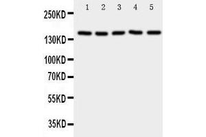 Western Blotting (WB) image for anti-Replication Factor C (Activator 1) 1, 145kDa (RFC1) (AA 46-64), (N-Term) antibody (ABIN3043075) (RFC1 抗体  (N-Term))