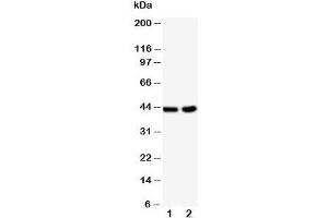 Western blot testing of BCAT1 antibody and Lane 1:  HeLa;  2: Jurkat cell lysate (BCAT1 抗体  (C-Term))