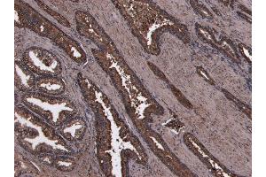 Immunohistochemistry (IHC) image for anti-Homeobox D13 (HOXD13) (Internal Region) antibody (ABIN6391406)