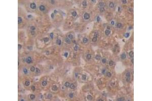 IHC-P analysis of Mouse Tissue, with DAB staining. (TPSAB1 抗体  (AA 149-273))