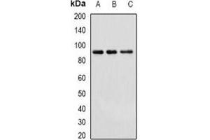 Western blot analysis of Cullin 4A expression in Hela (A), HepG2 (B), mouse brain (C) whole cell lysates. (Cullin 4A 抗体)