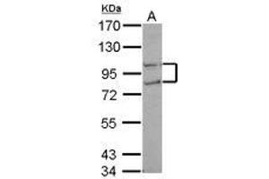 Image no. 1 for anti-CTD (Carboxy-terminal Domain, RNA Polymerase II, Polypeptide A) Phosphatase, Subunit 1 (CTDP1) (N-Term) antibody (ABIN1494011) (CTDP1 抗体  (N-Term))