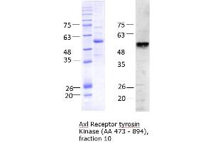 Quality Control Images: Western Blotting + SDS-PAGE (AXL Protein (AA 473-894) (His tag))
