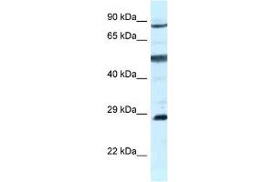 WB Suggested Anti-AK7 Antibody Titration: 1. (Adenylate Kinase 7 抗体  (C-Term))