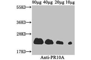 Western Blot Positive WB detected in: Coptis japonica (80 μg, 40 μg, 20 μg, 10 μg) All lanes: PR10A antibody at 3. (PR1a Precursor 抗体  (AA 20-196))