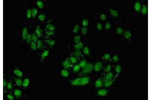 Immunofluorescent analysis of HepG2 cells using ABIN7155856 at dilution of 1:100 and Alexa Fluor 488-congugated AffiniPure Goat Anti-Rabbit IgG(H+L)