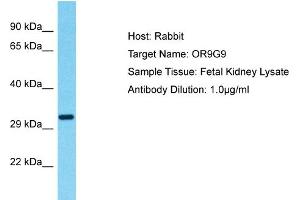 Host: Rabbit Target Name: OR9G9 Sample Type: Fetal Kidney lysates Antibody Dilution: 1. (OR9G9 抗体  (C-Term))
