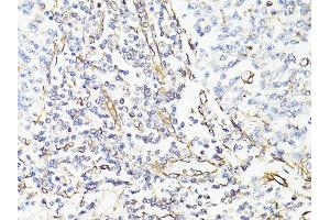 Immunohistochemistry (Paraffin-embedded Sections) (IHC (p)) image for anti-Vimentin (VIM) (AA 1-101) antibody (ABIN6150108)